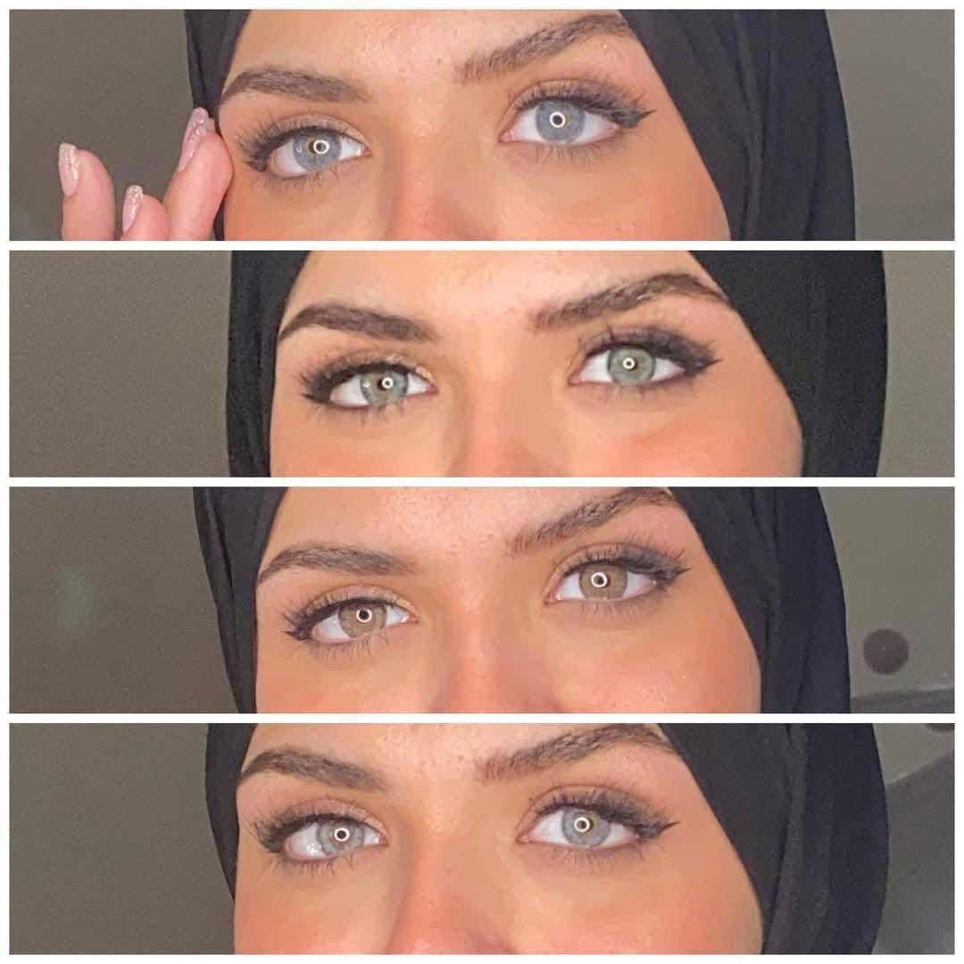 SIRI Eye Lenses